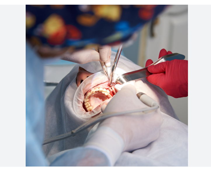 Precision dental surgery under strict sterilisation and magnification protocols